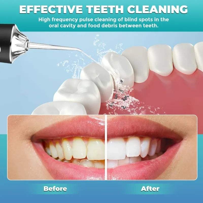 Portable Water Flosser