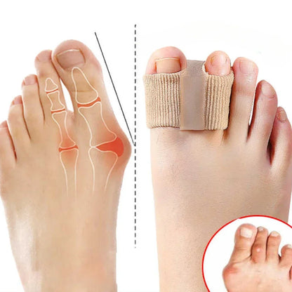 Toe Corrector
